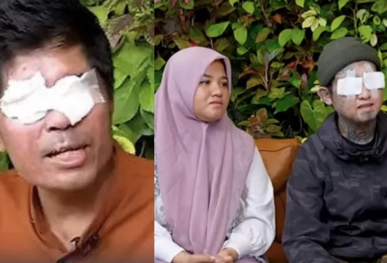 Beda dengan Kasus Agus, Faisal Korban Mata Dicongkel di Acara Vespa Tak Libatkan Uang Donasi