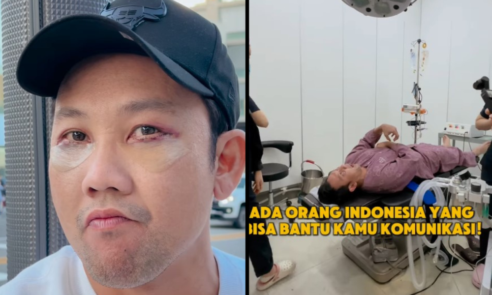 Demi Tampil Lebih Menarik, Denny Sumargo Lakukan Operasi Plastik di Korea