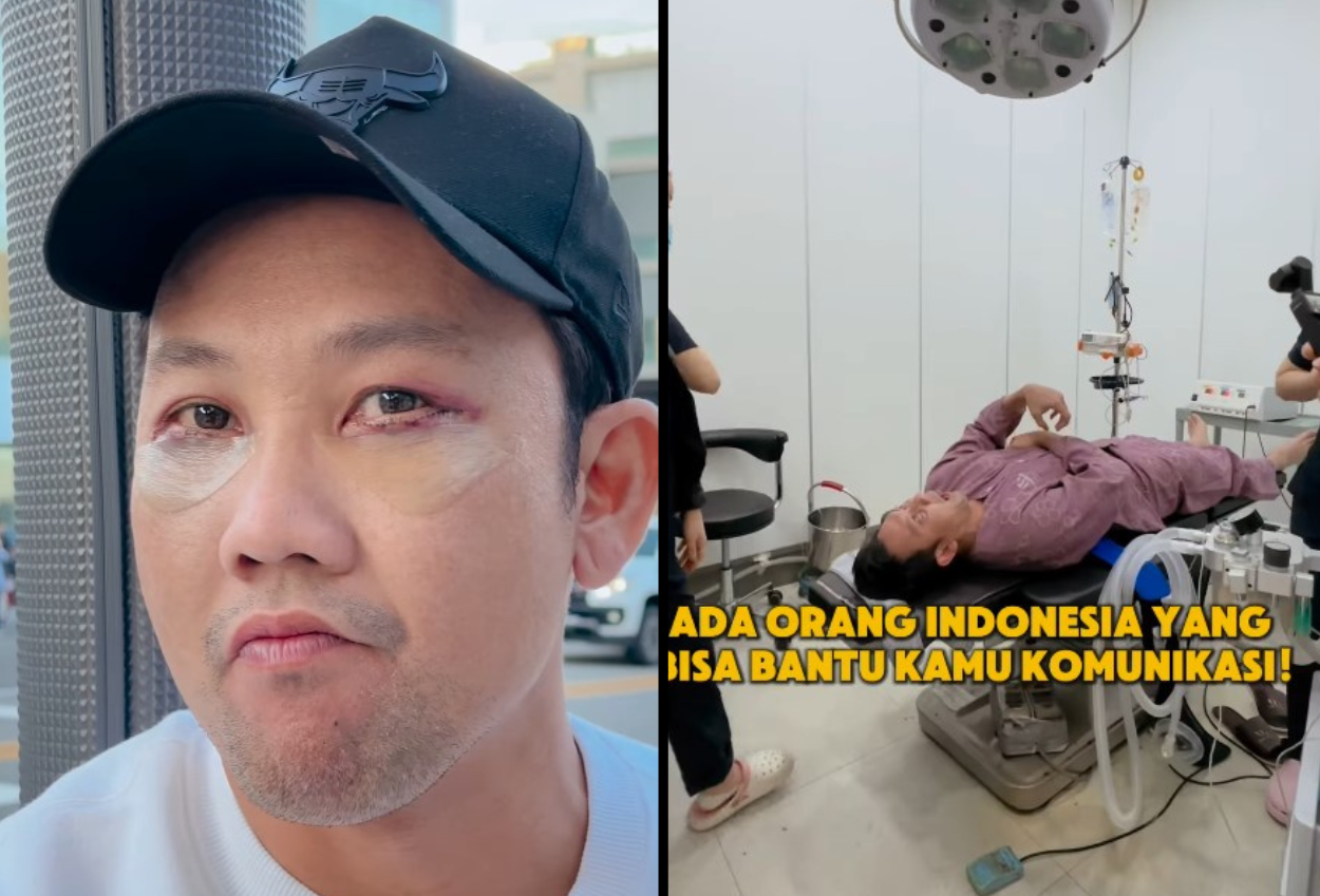 Demi Tampil Lebih Menarik, Denny Sumargo Lakukan Operasi Plastik di Korea