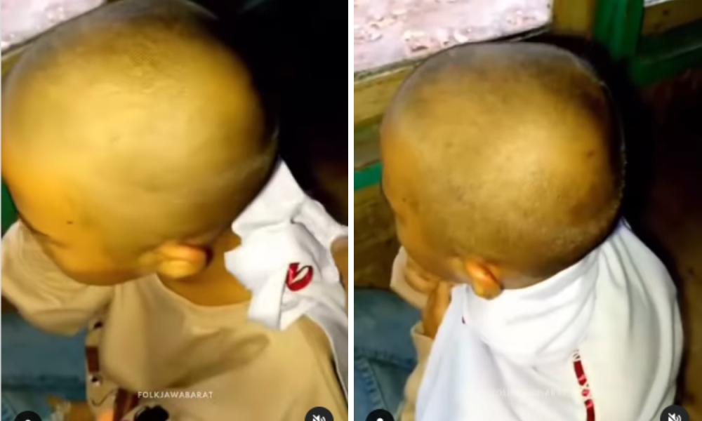 Siswi SD di Cianjur Enggan Sekolah Lagi Setelah Digunduli oleh Guru karena Kutu