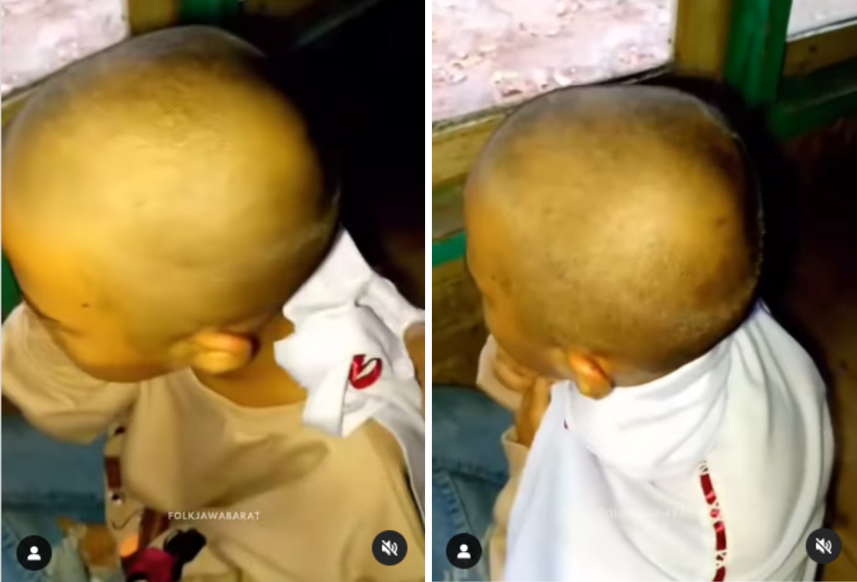 Siswi SD di Cianjur Enggan Sekolah Lagi Setelah Digunduli oleh Guru karena Kutu