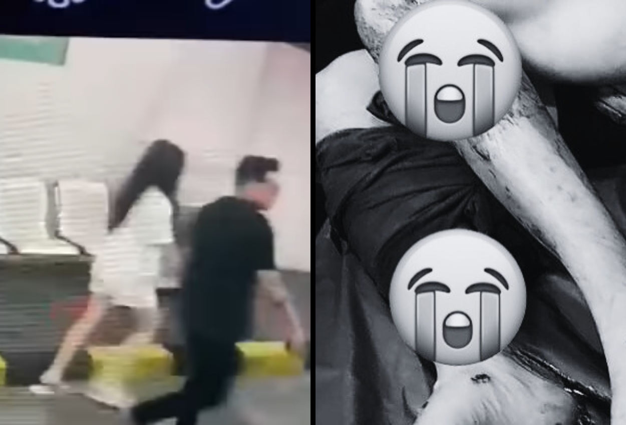 Pergoki Istri Selingkuh dengan 2 Pria, Suami Diseret Mobil hingga Tulangnya Patah