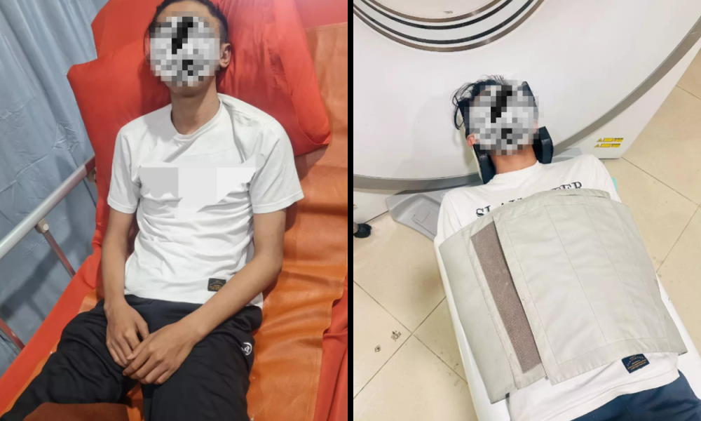 TikToker Nazmitsq Dikeroyok Geng Motor di Bandung hingga Luka di Paru paru