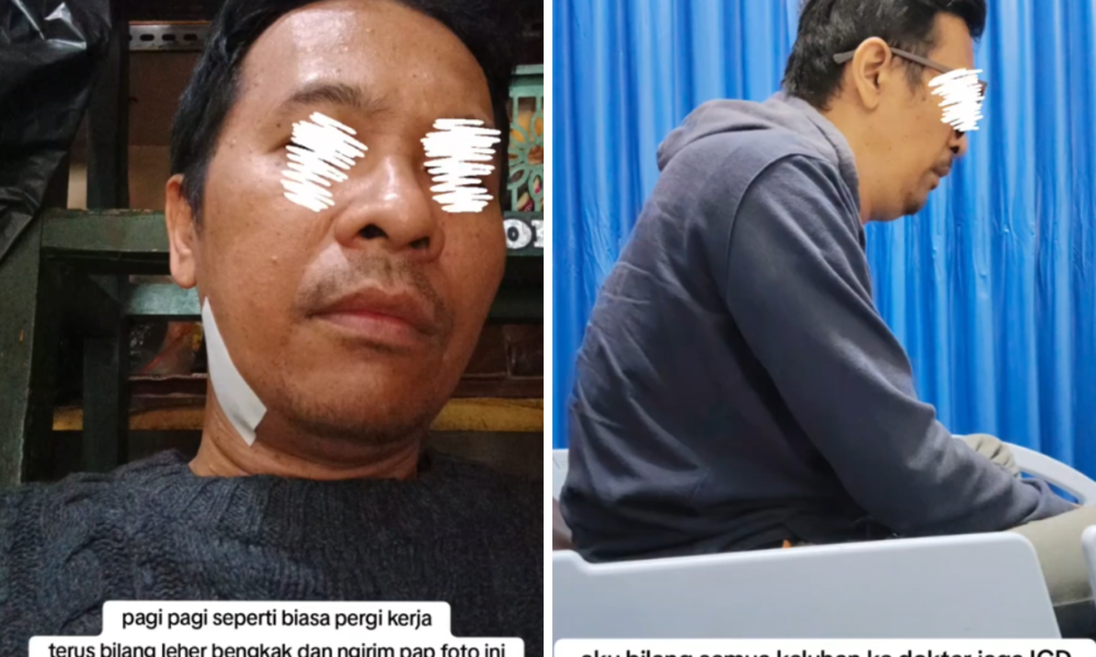 Istri Di Bandung Curhat Suaminya Meninggal Karena Gigi Berlubang