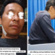 Istri Di Bandung Curhat Suaminya Meninggal Karena Gigi Berlubang