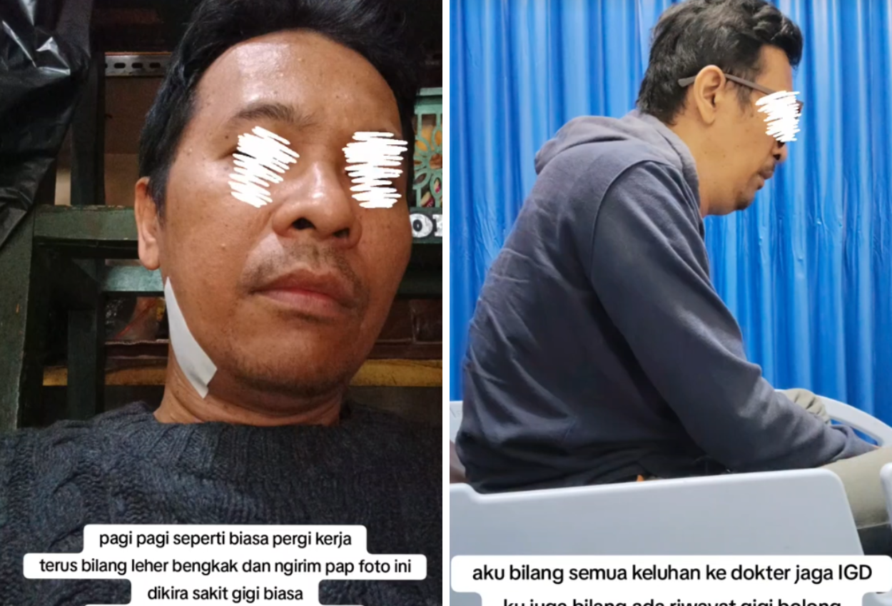 Istri Di Bandung Curhat Suaminya Meninggal Karena Gigi Berlubang