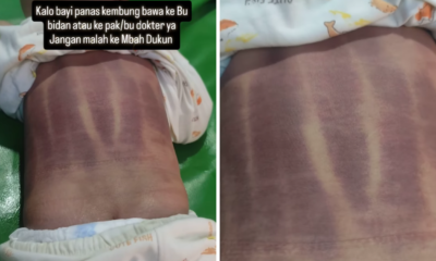 Viral Video, Bayi Kesakitan hingga Menangis usai Dikerokin