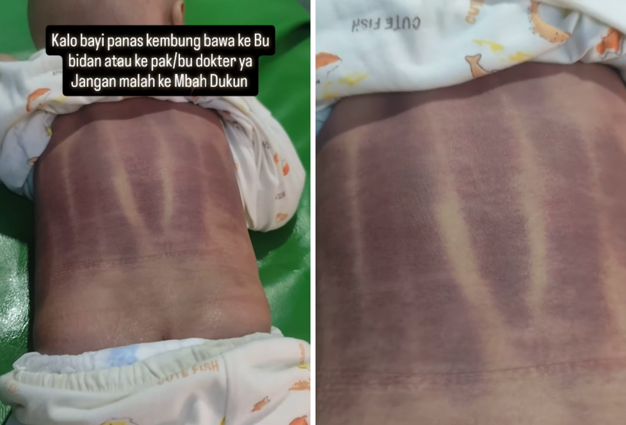 Viral Video, Bayi Kesakitan hingga Menangis usai Dikerokin