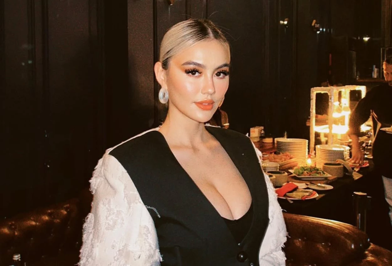 Akibat stress, agnez mo akui pernah idap autoimun 15 tahun yang lalu