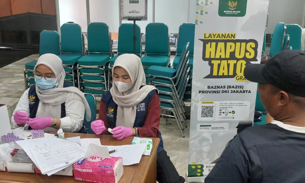 Antusias ikut program hapus tato baznas, peserta lebih sakit dihilangkan daripada membuat tato