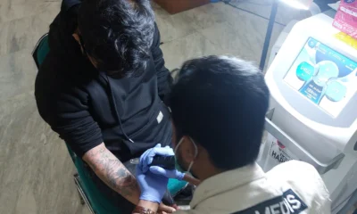 Berencana hapus tato baznas buka layanan gratis