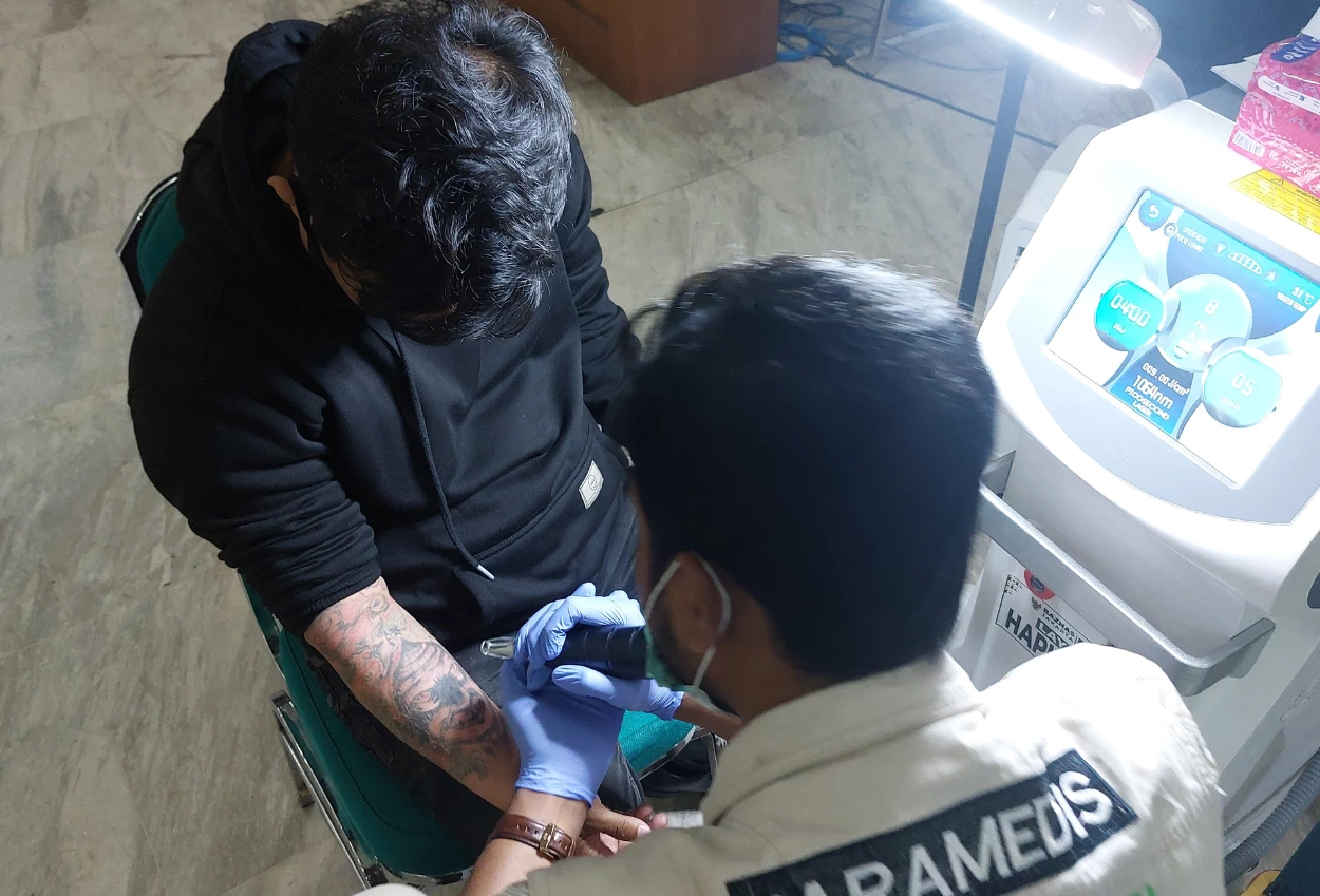 Berencana hapus tato baznas buka layanan gratis