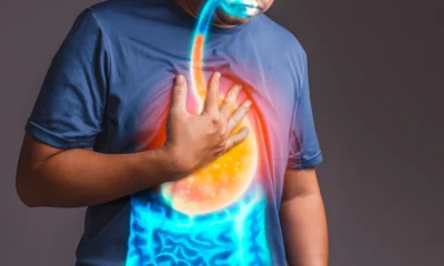 Bukan hanya makanan pedas, ini faktor lain yang memicu kenaikan asam lambung