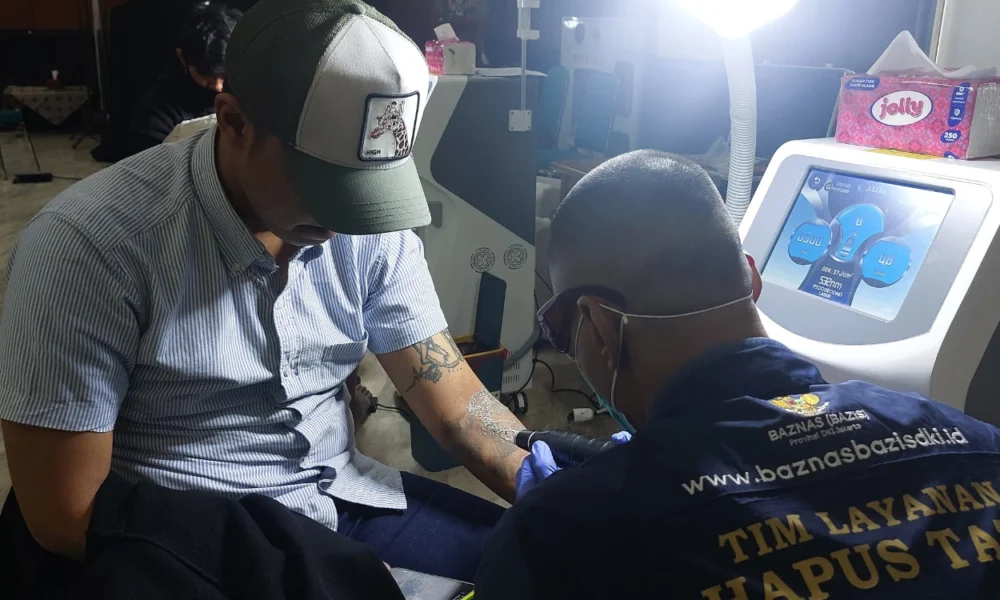 Demi hijrah, warga jakarta timur manfaatkan program hapus tato gratis baznas
