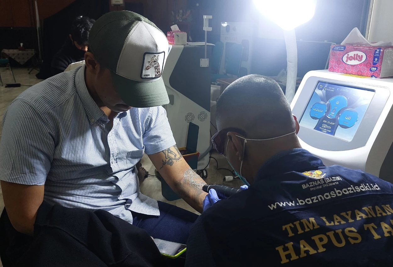 Demi hijrah, warga jakarta timur manfaatkan program hapus tato gratis baznas