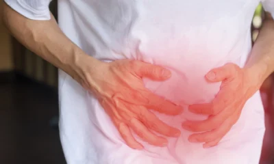 Mengenal perbedaan asam lambung naik, gerd, dan gastritis