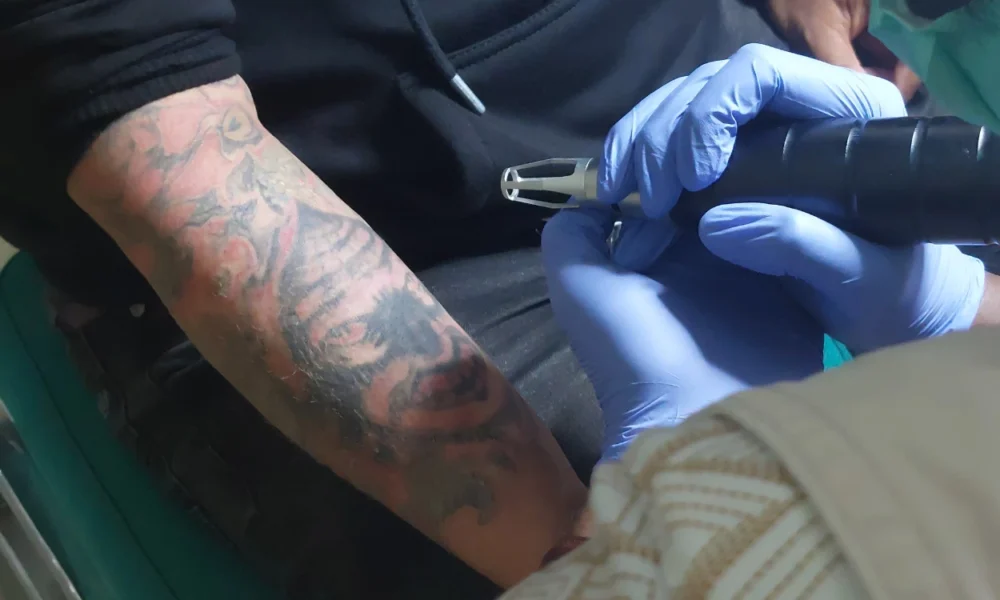Program hapus tato gratis baznas diserbu ratusan peserta