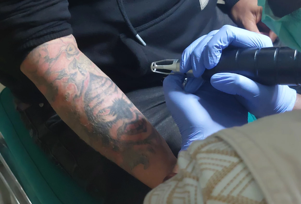 Program hapus tato gratis baznas diserbu ratusan peserta