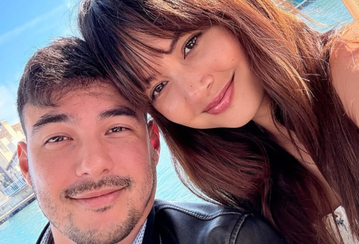 Aurelie moeremans alami penyusutan otak usai kecelakaan, suami beri dukungan spesial