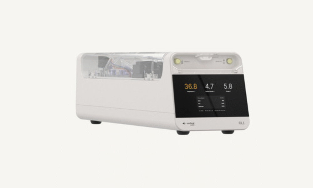 Mpnbagas(1250 x 849 px) mpn 2025 05 02t135924.002