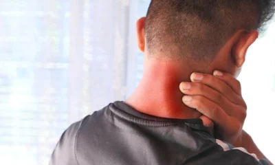 Sakit sendi saat demam ini penjelasan ilmiah dan solusinya