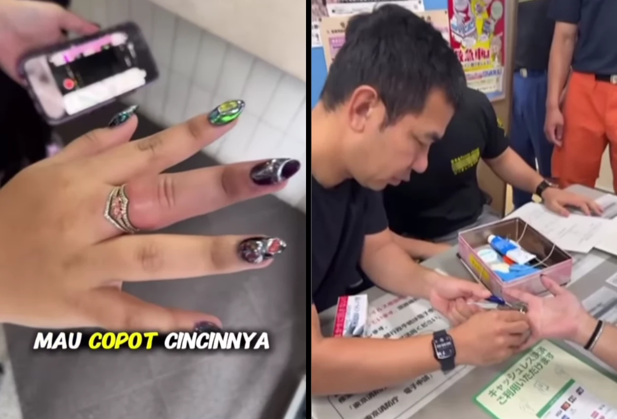 Eko patrio minta tolong damkar di jepang usai putrinya alami ini