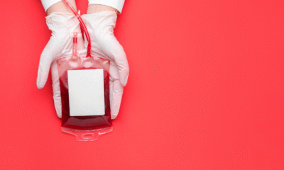 Ini yang Terjadi pada Tubuh jika Kamu Donor Darah