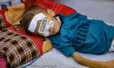Inggris siap evakuasi 300 anak sakit parah dari gaza