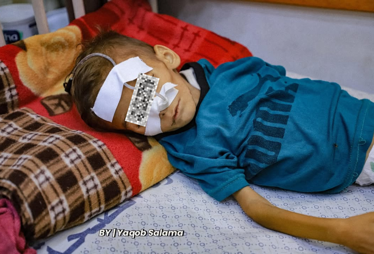 Inggris siap evakuasi 300 anak sakit parah dari gaza