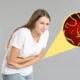 Mengenal 10 fakta soal cacing gelang, parasit yang bisa hidup di ususmu!
