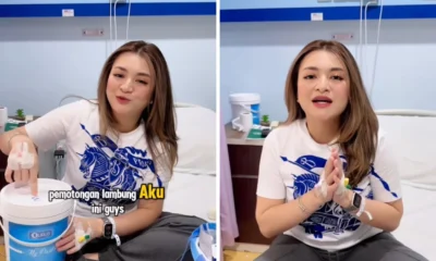 Bukan hanya mau diet, ini alasan nathalie holscher jalani operasi bariatrik