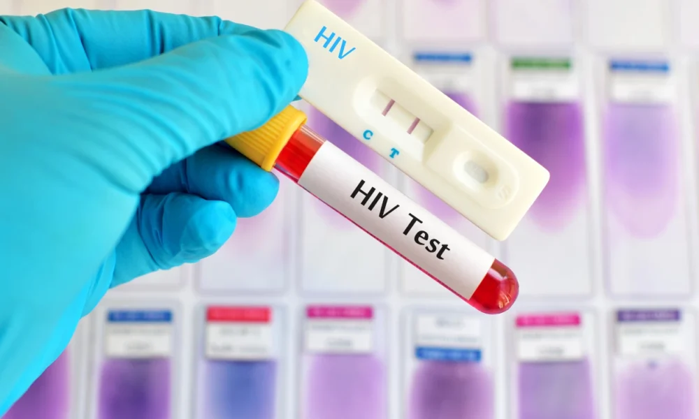 Dinkes tangerang catat 374 kasus hivaids, 4 balita turut terpapar