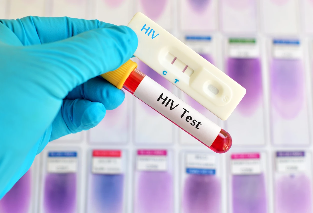 Dinkes tangerang catat 374 kasus hivaids, 4 balita turut terpapar