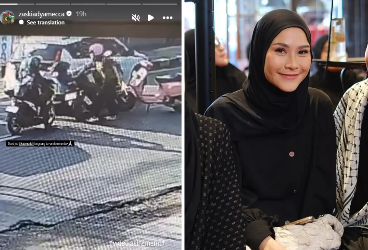 Karyawan dianiaya, zaskia adya mecca sudah visum dan lapor polisi