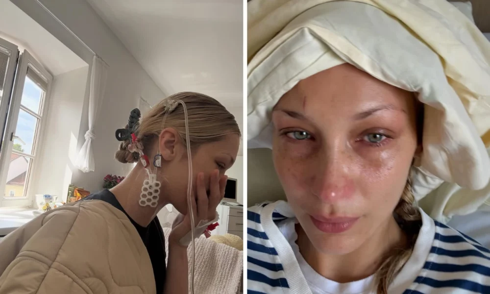 Kembali diserang lyme disease, bella hadid unggah foto dirawat di rumah sakit