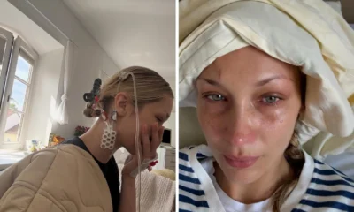Kembali diserang lyme disease, bella hadid unggah foto dirawat di rumah sakit