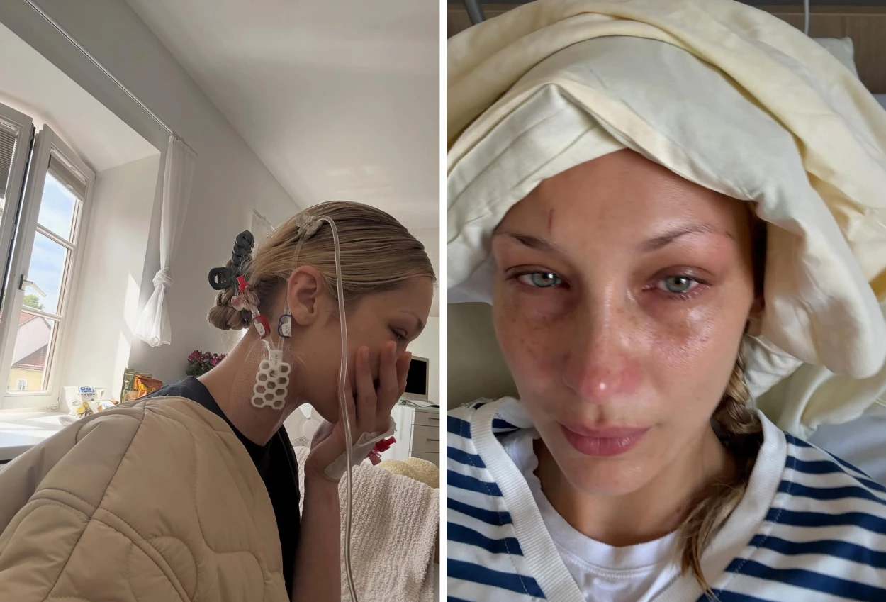 Kembali diserang lyme disease, bella hadid unggah foto dirawat di rumah sakit