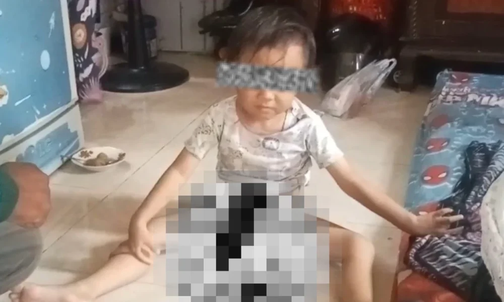 Viral! bocah 4,5 tahun di jagakarsa diduga disunat gaib