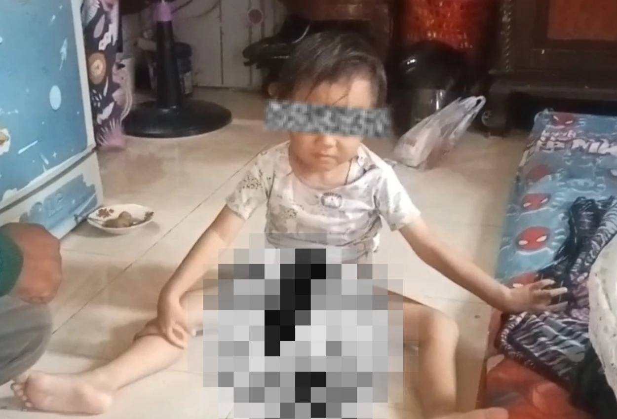 Viral! bocah 4,5 tahun di jagakarsa diduga disunat gaib