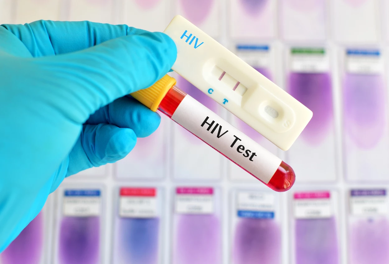 Sebanyak 29 pria yang terlibat pesta gay di surabaya positif hivaids
