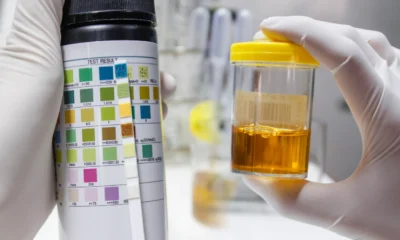 Warna urine bisa jadi petunjuk penyakit serius, kenali perbedaannya