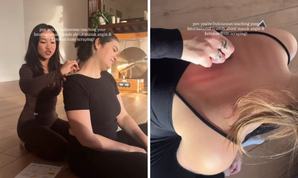 Viral di sosmed! guru yoga asal indonesia kenalkan kerokan dan masuk angin ke komunitas yoga new york
