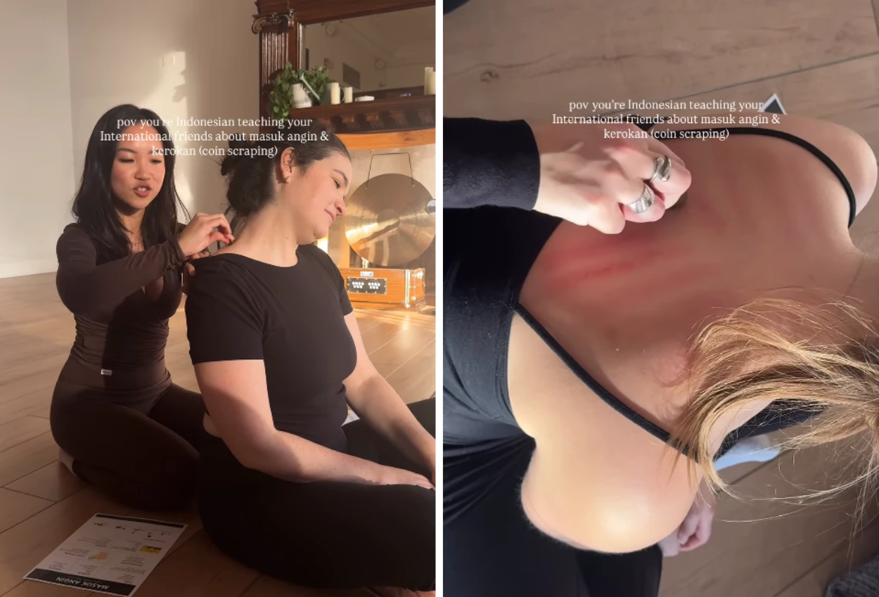 Viral di sosmed! guru yoga asal indonesia kenalkan kerokan dan masuk angin ke komunitas yoga new york