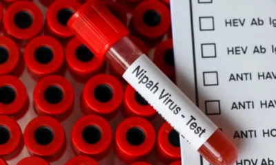 Apa itu nipah virus yang belum ada obatnya!