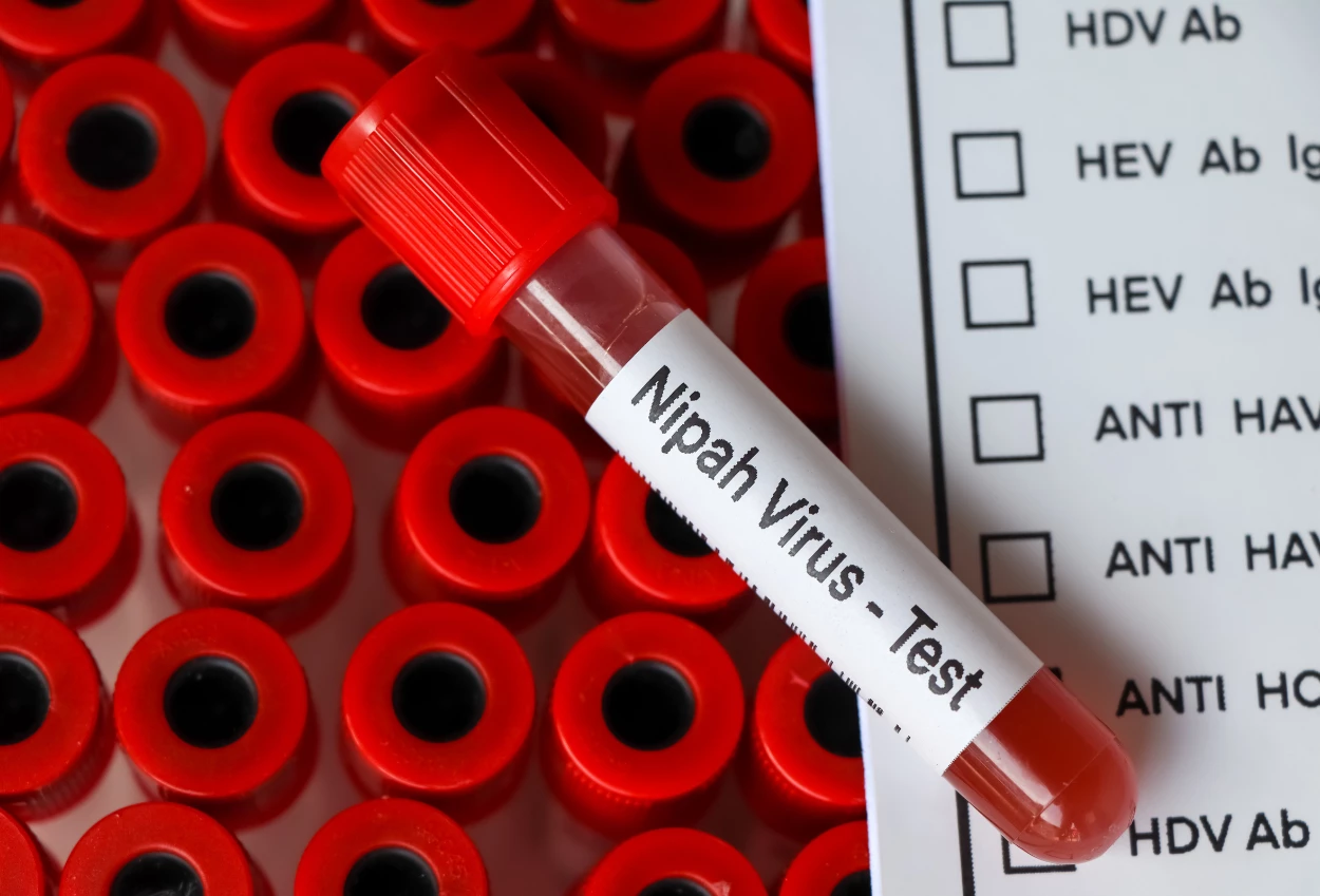 Apa itu nipah virus yang belum ada obatnya!