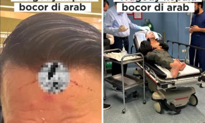 Kepala arie untung bocor saat umrah, begini ceritanya!