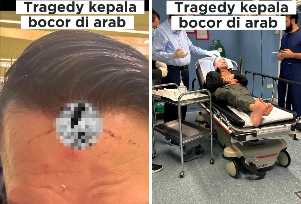 Kepala arie untung bocor saat umrah, begini ceritanya!
