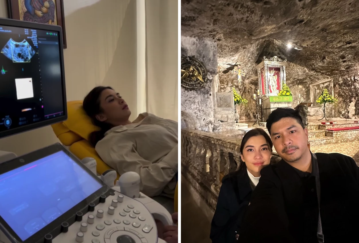 Wow! glenn alinskie sebut chelsea olivia hamil kembar 8 namanya siapa aja ya