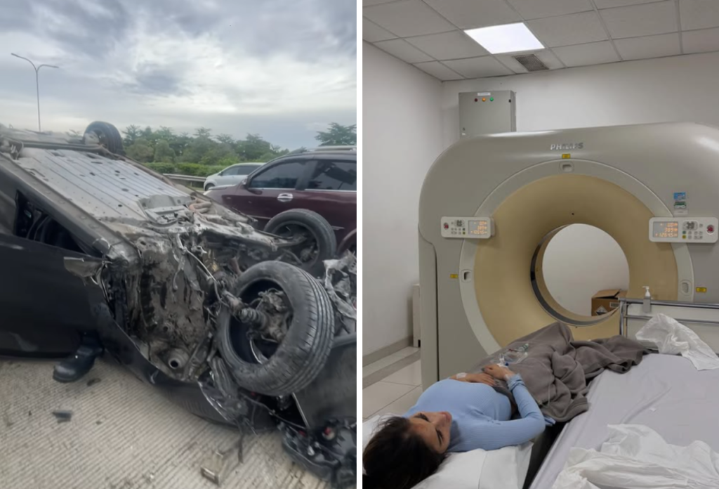 Model Diva Siregar Kecelakaan di Tol Jagorawi, Mobil Ringsek Parah hingga Terbalik (1)