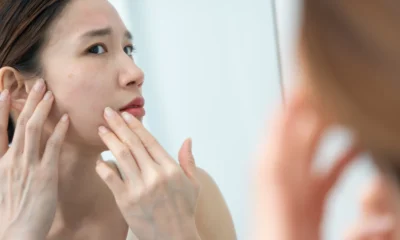 Pori Pori Wajah Terlihat Besar Lakukan 10 Cara Alami Ini